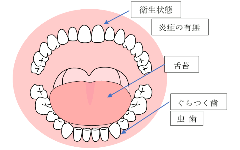 口腔内の状態